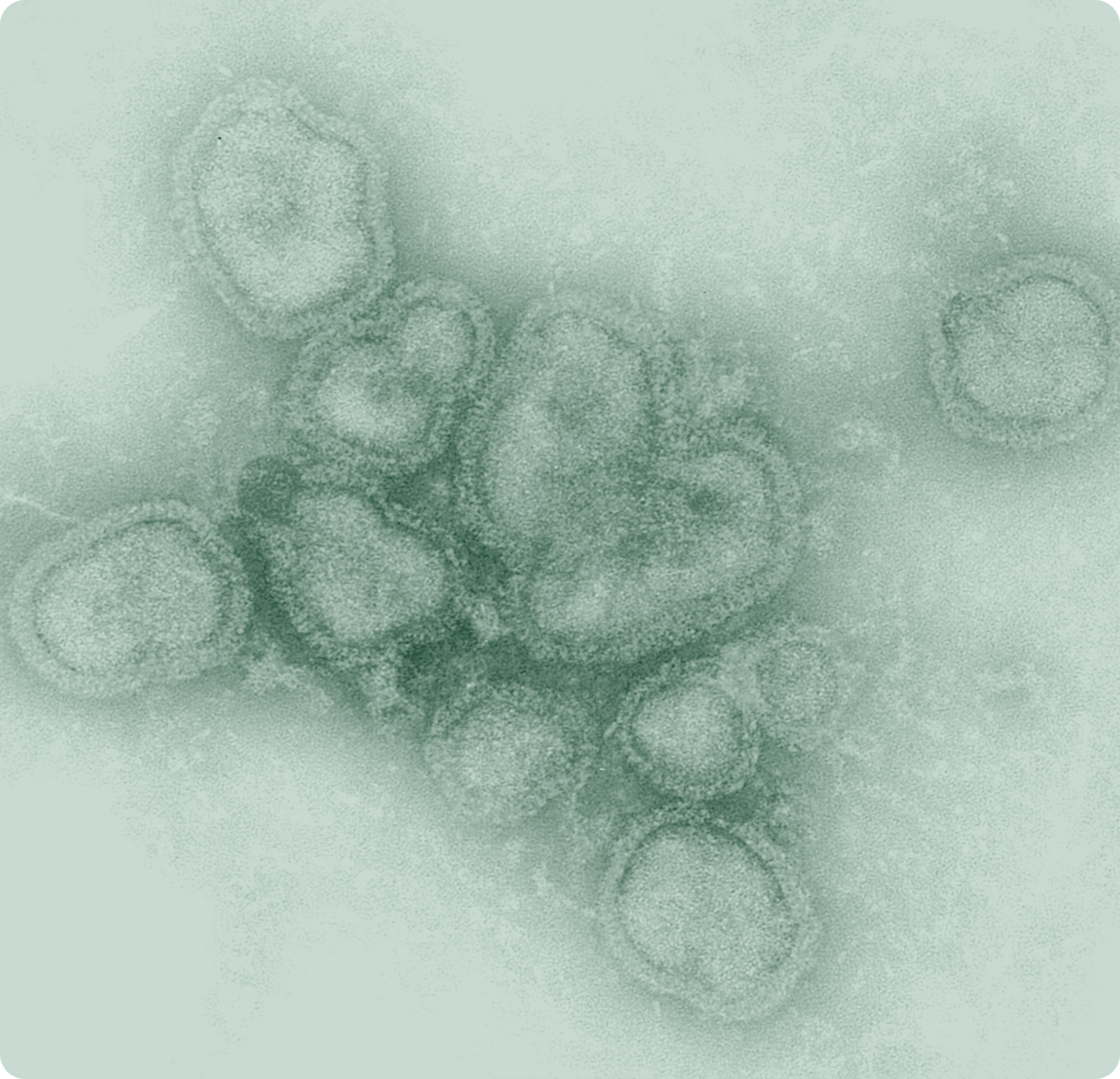 Electron microscope showing clustered round viral particles in green tones